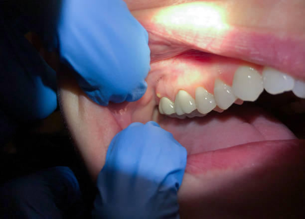 Best Emergency Dental Services for Seniors in Highfill, AR