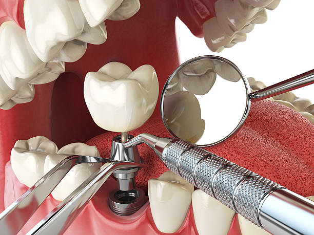 Best Emergency Dental Care for Abscessed Tooth in Highfill, AR